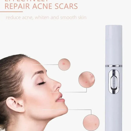 Beauty Essentials Laser pen blue light - beauty essentials - Dearbeauty - Mad Fly Essentials