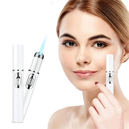 Beauty Essentials Laser pen blue light - beauty essentials - Dearbeauty - Mad Fly Essentials