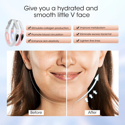 Massager Pro LED Double Chin Removal USB Skin Care Facial Device - Massager - Dearbeauty - Mad Fly Essentials