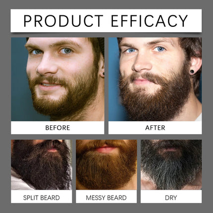 Beard Care 60mL Growth Serum Moisturize Nourish Roots Kit - Beard Care - Blue Zoo - Mad Fly Essentials