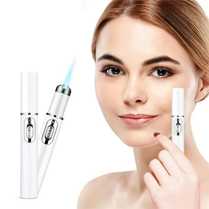 Beauty Essentials Laser pen blue light - Beauty Essentials - DearBeauty - Mad Fly Essentials